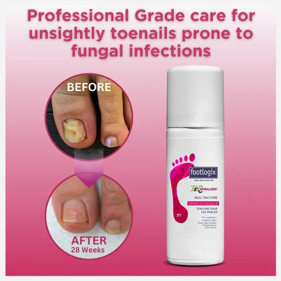 Footlogix Toe Nail Tincture (50ml)